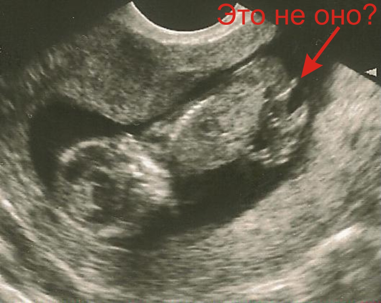 фото малыша в 13 недель