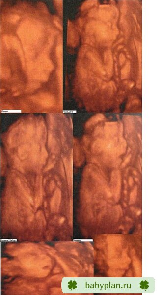 4Д УЗИ на сроке 22н2дн Доченька лапулечка)))думали ..что сынок ;)
