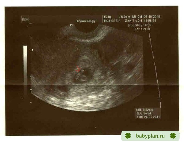Беременность 6 недель и 3 дня