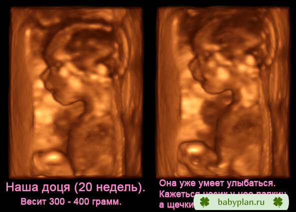 3D узи (20 недель). Наше личико.