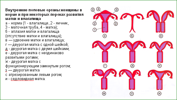 Двурогая матка