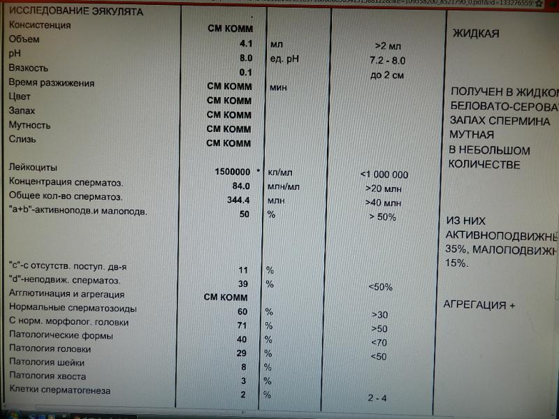 Спермограмма (доступно в Сергиевом Посаде) | Парацельс