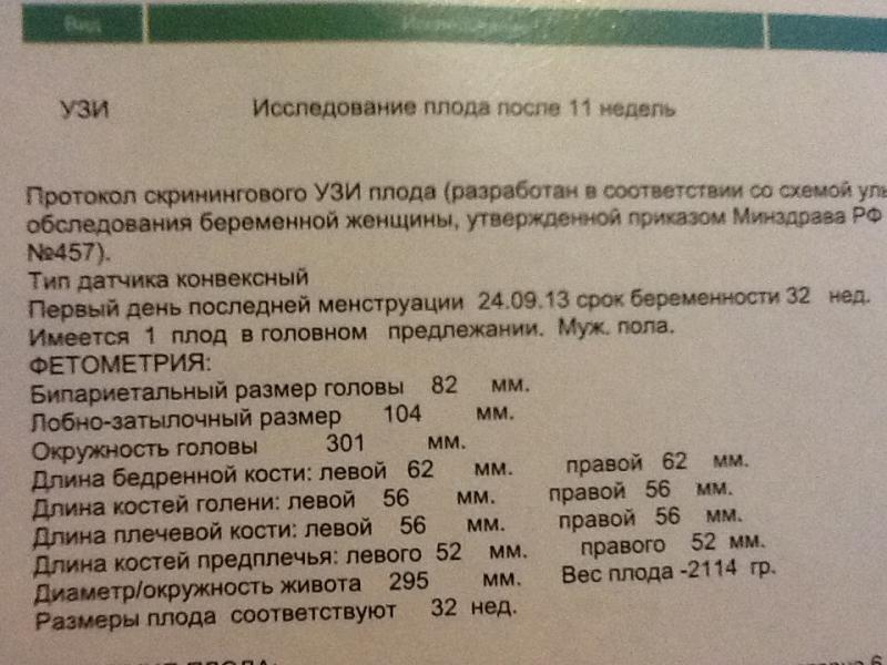 Длина бедренной. Фетометрия на 30 неделе беременности. Фетометрия плода по неделям. Расшифровка фетометрии плода. Фетометрия плода 20 недель норма.