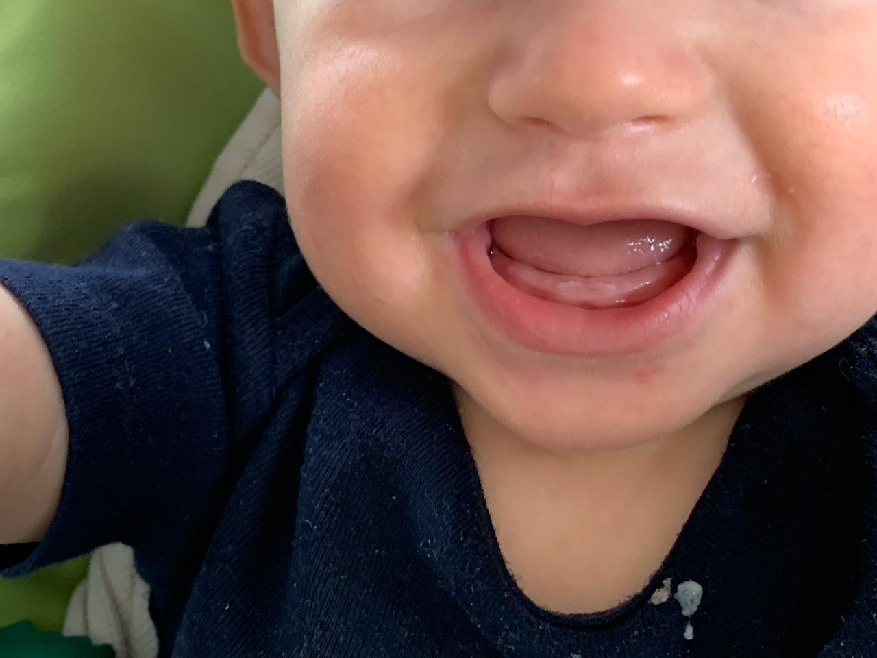 зубы у малышей фото