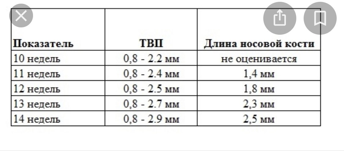 Толщина воротникова пространства. Носовая кость в 13 недель норма таблица. Носовая кость в 12 недель норма таблица. Длина носовой кости в 12 недель норма таблица. Носовая кость у плода в 12 недель норма таблица.